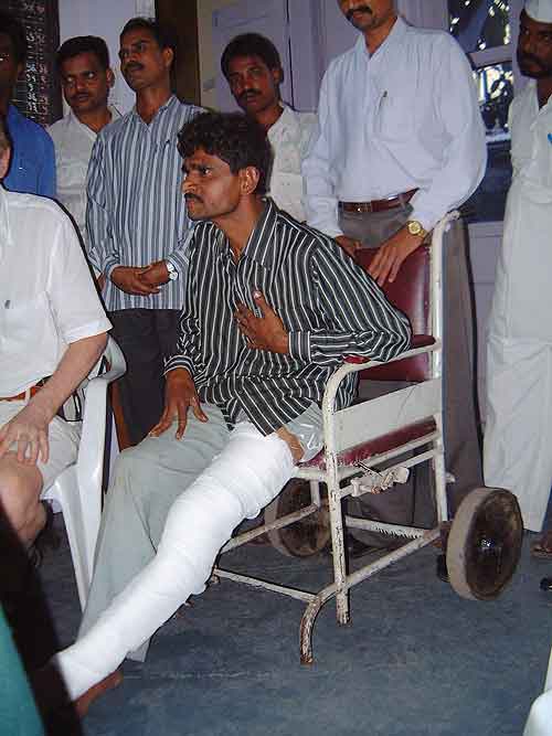 Street crime in Mumbai, India: In 2001, we spoke to this pickpocket in Mumbai, who'd been beaten by his victim.